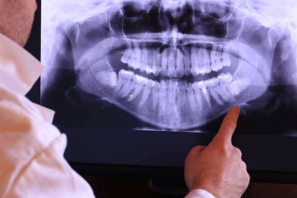 Best Knocked-Out Tooth Emergency  in Rancho Laveras, CA